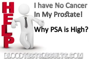 PSA False Results