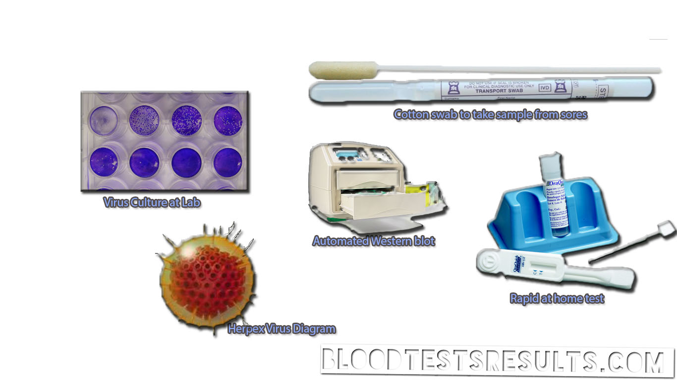 blood tests for herpes virus