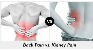 backpain and kidney pain creatinine